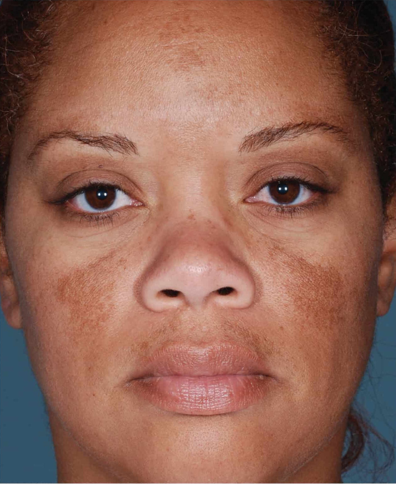 Translation missing: en.Before image