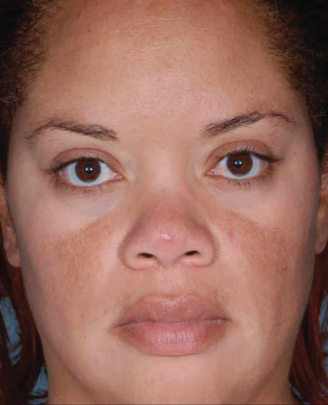 Translation missing: en.After image